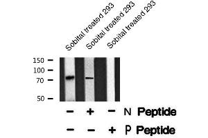 Image no. 2 for anti-Protein Kinase C, gamma (PRKCG) (pThr514) antibody (ABIN6271860)