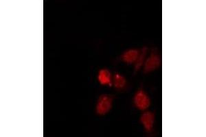 Image no. 1 for anti-S100 Calcium Binding Protein A5 (S100A5) antibody (ABIN6257488)