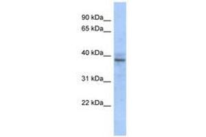 Image no. 1 for anti-Zinc Finger Protein 625 (ZNF625) (AA 67-116) antibody (ABIN6740632)