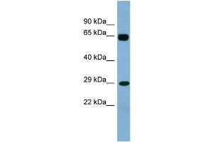 Image no. 1 for anti-LRRN4 C-terminal Like (LRRN4CL) (Middle Region) antibody (ABIN2786456)