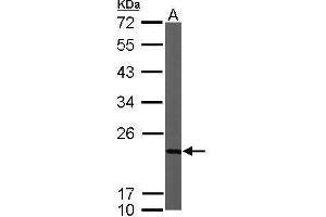 Image no. 3 for anti-NADH Dehydrogenase (Ubiquinone) 1 beta Subcomplex, 9, 22kDa (NDUFB9) (Center) antibody (ABIN2856130)