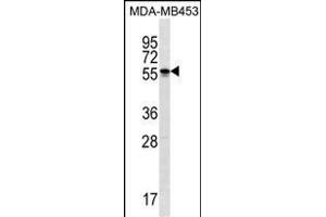 SOHLH2 Antibody (Center) (ABIN1538138 and ABIN2849993) western blot analysis in MDA-M cell line lysates (35 μg/lane).