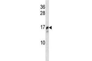 Image no. 2 for anti-Trafficking Protein Particle Complex 2 (TRAPPC2) (AA 11-39) antibody (ABIN3029192)