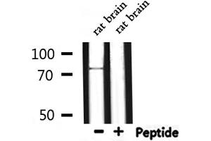 Image no. 2 for anti-Forkhead Box P1 (FOXP1) (C-Term) antibody (ABIN6261807)