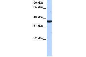 Image no. 1 for anti-Tumor Protein P53 Inducible Protein 13 (TP53I13) (C-Term) antibody (ABIN2784582)