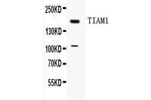 Image no. 1 for anti-T-Cell Lymphoma Invasion and Metastasis 1 (TIAM1) (AA 1518-1554), (C-Term) antibody (ABIN4886742)
