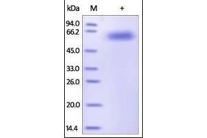 Image no. 2 for Interleukin 2 Receptor, beta (IL2RB) (AA 27-239) (Active) protein (Fc Tag) (ABIN2181388)