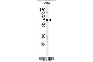 Western Blotting (WB) image for anti-Carboxypeptidase M (CPM) (Center) antibody (ABIN2160281)