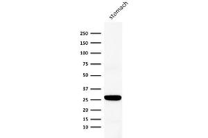 Image no. 1 for anti-Gap Junction Protein, beta 1, 32kDa (GJB1) antibody (ABIN6939515)