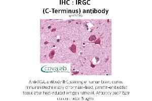 Image no. 1 for anti-Immunity-Related GTPase Family, Cinema (IRGC) (C-Term) antibody (ABIN1736035)