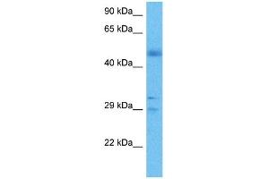 Image no. 4 for anti-Fibroblast Growth Factor 2 (Basic) (FGF2) (Middle Region) antibody (ABIN2777106)