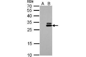 Kallikrein 7 antibody  (Center)