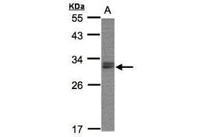 Image no. 1 for anti-Non-SMC Element 1 Homolog (NSMCE1) (Center) antibody (ABIN2856490)
