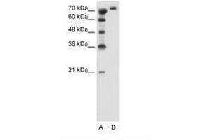 Image no. 2 for anti-Solute Carrier Family 6, Member 18 (SLC6A18) (AA 351-400) antibody (ABIN205030)
