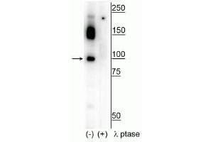 Image no. 1 for anti-Retinoblastoma Binding Protein 8 (RBBP8) (pSer326) antibody (ABIN6254026)