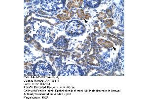 Image no. 1 for anti-Complement Component 4 Binding Protein, beta (C4BPB) (N-Term) antibody (ABIN2778139)