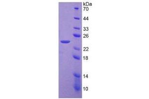 Image no. 1 for phosphoenolpyruvate Carboxykinase 2 (Mitochondrial) (PEPCK) (AA 33-198) protein (His tag) (ABIN6237434)