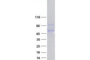 Image no. 1 for Protein Phosphatase 2, Regulatory Subunit B', gamma (PPP2R5C) (Transcript Variant 1) protein (Myc-DYKDDDDK Tag) (ABIN2729493)