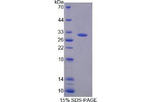 Image no. 1 for Quiescin Q6 Sulfhydryl Oxidase 1 (QSOX1) (AA 33-281) protein (His tag) (ABIN6237808)