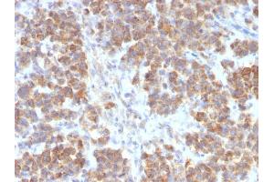 Image no. 4 for anti-Tumor Necrosis Factor (Ligand) Superfamily, Member 15 (TNFSF15) antibody (ABIN6941291)