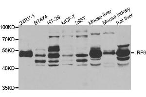 Image no. 1 for anti-Interferon Regulatory Factor 6 (IRF6) antibody (ABIN1882373)