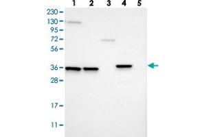 Image no. 1 for anti-Mitochondrial Amidoxime Reducing Component 2 (MARC2) antibody (ABIN5583169)