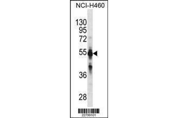 anti-Cytochrome P450, Family 2, Subfamily C, Polypeptide 9 (CYP2C9) (AA 82-110), (N-Term) antibody