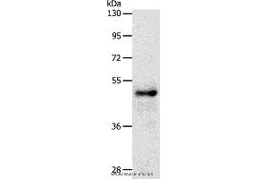 Image no. 1 for anti-SRY (Sex Determining Region Y)-Box 8 (SOX8) antibody (ABIN2426907)