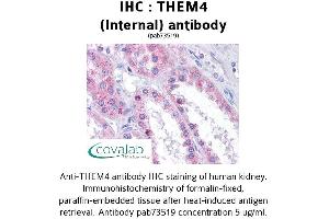 Image no. 1 for anti-Thioesterase Superfamily Member 4 (THEM4) (Internal Region) antibody (ABIN1740039)
