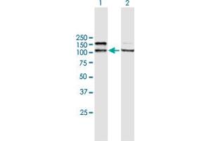 Image no. 4 for anti-Adenosine Deaminase, RNA-Specific (ADAR) (AA 1-1226) antibody (ABIN513112)