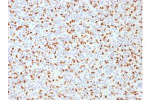 Image no. 5 for anti-Spleen Focus Forming Virus (SFFV) Proviral Integration Oncogene Spi1 (SPI1) (AA 16-170) antibody (ABIN6940631)