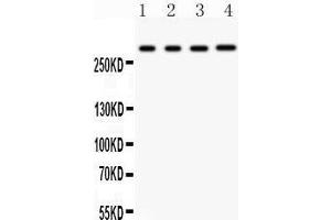 anti-Inositol 1,4,5-Trisphosphate Receptor, Type 1 (ITPR1) (AA 2411-2758) antibody