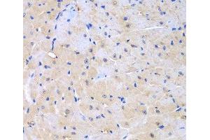 Immunohistochemistry of paraffin-embedded Mouse heart using ARHGEF9 Polyclonal Antibody at dilution of 1:100 (40x lens).