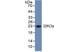 Rabbit Detection antibody from the kit in WB with Positive Control: Sample Cell culture supernatant and 293F cell lysate which transfected with mouse IL1b gene.