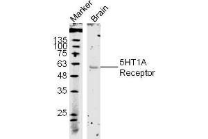 Image no. 2 for anti-Serotonin Receptor 1A (HTR1A) (AA 301-400) antibody (ABIN738006)