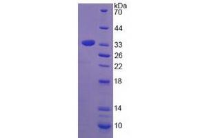 Image no. 1 for Tryptase beta 2 (TPSB2) (AA 30-274) protein (His tag) (ABIN6238443)