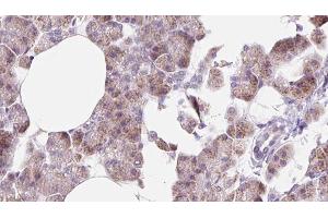 Image no. 2 for anti-Dynactin 6 (DCTN6) (Internal Region) antibody (ABIN6261245)