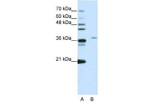 anti-Squamous Cell Carcinoma Antigen Recognized By T Cells 3 (SART3) (N-Term) antibody