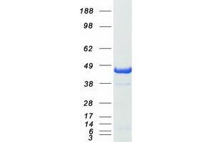 Image no. 1 for PRKC, Apoptosis, WT1, Regulator (PAWR) protein (Myc-DYKDDDDK Tag) (ABIN2728222)