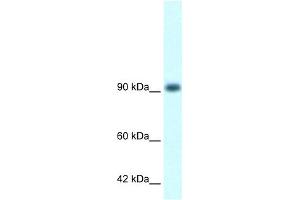Image no. 4 for anti-RNA Binding Motif Protein 10 (RBM10) (N-Term) antibody (ABIN2779276)
