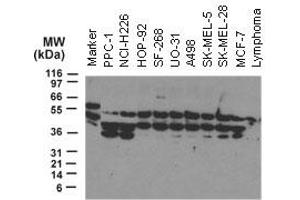 Image no. 2 for anti-Nucleotide-Binding Oligomerization Domain Containing 2 (NOD2) (AA 582-600) antibody (ABIN957221)