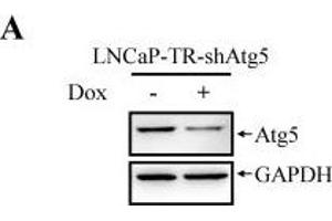 Image no. 44 for anti-Glyceraldehyde-3-Phosphate Dehydrogenase (GAPDH) (Center) antibody (ABIN2857072)