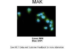 Image no. 3 for anti-Male Germ Cell-Associated Kinase (MAK) (C-Term) antibody (ABIN2775329)