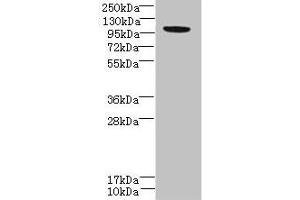 PPFIBP2 Antikörper  (AA 101-400)