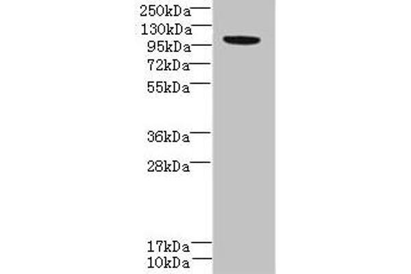 PPFIBP2 Antikörper  (AA 101-400)