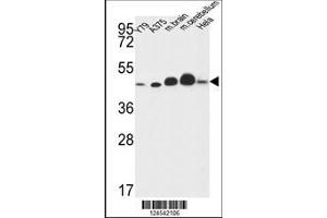 anti-NADH Dehydrogenase (Ubiquinone) Fe-S Protein 2, 49kDa (NADH-Coenzyme Q Reductase) (NDUFS2) (AA 286-315) antibody