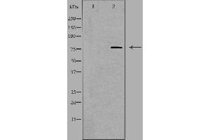 Image no. 3 for anti-SKI-Like Oncogene (SKIL) antibody (ABIN6258322)