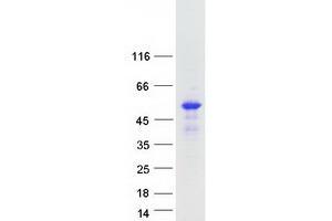 Image no. 1 for Synaptotagmin XII (SYT12) protein (Myc-DYKDDDDK Tag) (ABIN2733068)