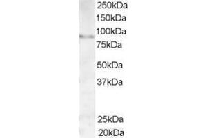 anti-A Kinase (PRKA) Anchor Protein 3 (AKAP3) (C-Term) antibody