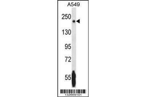 Image no. 2 for anti-Nik Related Kinase (NRK) (AA 721-750) antibody (ABIN1881588)